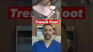 Trench Foot Could Lead To An Amputation #medical #viral #health