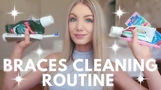 Braces Cleaning Routine | Water Flosser, Keeping Teeth White, Brushing etc.