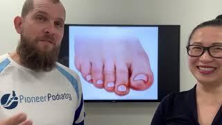 Do you suffer with ingrowing toenails ?