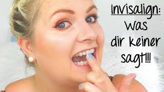 Invisalign Zahnspange: Was der Zahnarzt dir nicht sagt!!!  Tipps