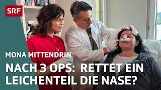 Botox, Brust-OP und Nasenkorrektur – Wie weit gehen wir für Schönheit? | Mona mittendrin 2024 | SRF