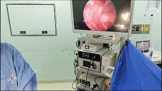 Endoscopic Disc Surgery: Live Demonstration