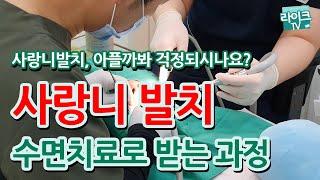 사랑니 수면마취  ,  매복사랑니 발치 치료 과정( 자고일어나면 치료 끝!)