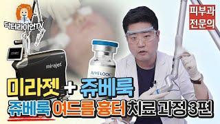 닥터라이언이 직접 보여주는 쥬베룩 여드름 흉터 치료 과정 3편 (미라젯 + 쥬베룩)
