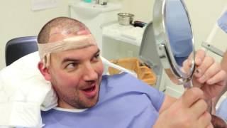 FUE Hair Transplant - What to Expect on the Day of Your Hair Transplant Surgery | Doug's FUE Diary