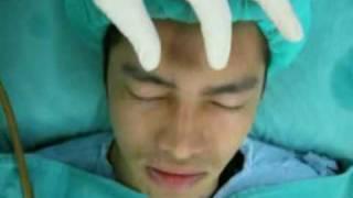 close reduction of nasal fracture, 鼻骨復位術,鼻骨骨折