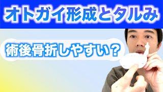 オトガイ形成でタルみやすい手術法ってあるの？術後の骨折の話も。