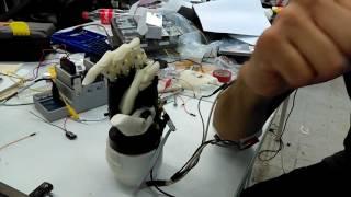 Prosthetic Hand EMG Exiii Hackberry Test #2