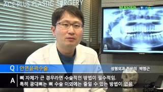 페이스플러스성형외과_박정근원장님_안면윤곽수술