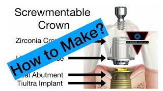 How to make - ScrewMentable Implant Crown - On1 TiBase Abutment