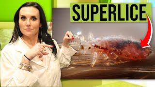 SuperLice