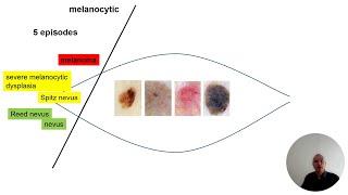 Fit for Dermoscopy Intro Series 2 - Melanocytic lesions