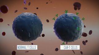 A Look at How CAR-T Cell Therapy Works