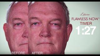 L'dara Flawless Now™ Demo