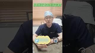 하안검과 미니하안검 차이는 어떻게 되나요?