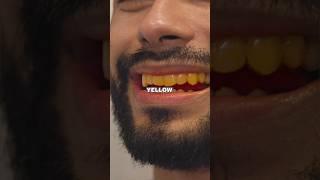 Yellow Teeth Problem Solved | Mridul Madhok