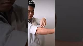 Wrist pain, mum wrist self treating