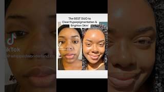 Musthave DUO for Natural Glass Skin!| Whippedwonderlandskincare