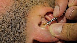 PERFECT SKIN CARE ACNE CLEANING FROM ASMR BARBER