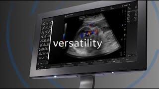 idsMED Introducing GE Versana Essential Launch Video