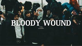 *FREE* Uk Drill type beat 2023 - '' Bloody Wound ''