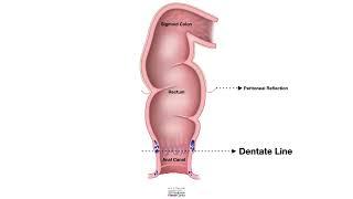 HCC 1475 7b  Rectum Anus Anatomy