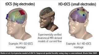 "Neuromodulation for Neuroergonomics" talk by Marom Bikson 2018