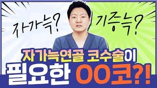자가늑연골 코성형 총정리, 구축코 짧은코 들창코 모두 모엿!