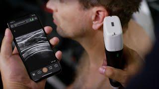 Clarius HD - The Next Generation of Wireless Handheld Ultrasound