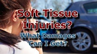 Chicago Personal Injury Lawyer - What Damages Can I Claim?