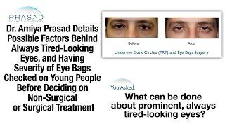 What Causes Tired Eyes in Young People, and Eye Puffiness Treatment Options