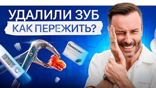 Удалить зуб легко, ЕСЛИ… Что НЕЛЬЗЯ делать после удаления?