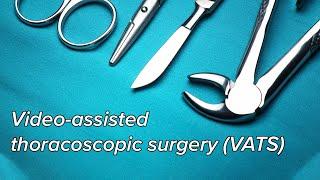 Video-assisted thoracoscopic surgery (VATS) - Pleural biopsy