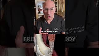 Fully Torn ACL: Can It Heal?  #shorts