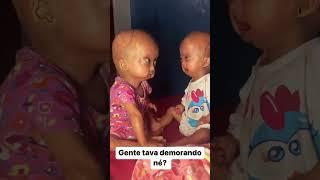 24 Elis e Eloá  #progeria #irmagemeas #eliseeloa #criancasespeciais #fyp #eloa #elis