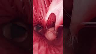  Tricuspid & Pulmonary Valves: Guardians of Blood Flow   #anatomy