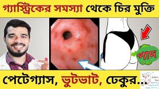 ঔষধ ছাড়া পেটেগ্যাস ভুটভাট ঢেকুর থেকে চিরতরে মুক্তির উপায় | Gastric Cause Foods to avoid & Eat