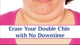 A Non-Surgical Neck Lift - Surgeon Minute