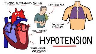 Causes of Hypotension - What causes Low Blood Pressure? (with Signs and Symptoms)