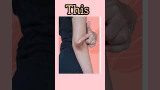 Dark skin on neck and elbows and  arm's try tretinoin #shortsfeed #skincare #tretinoin