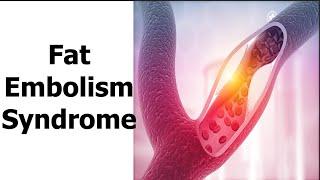 Fat Embolism Syndrome