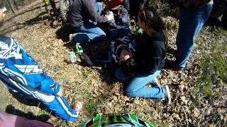 Broke leg in 2 places! MOTOCROSS CRASH DURING RACE!