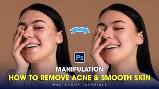 Adobe Photoshop 2025 Tricks: Remove Acne, Smooth Skin with Simple Steps in Minutes