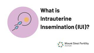 Intrauterine Insemination