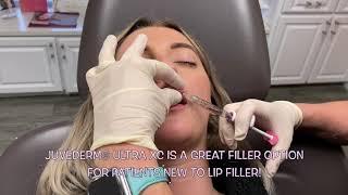 Lip Filler with Juvéderm Ultra XC