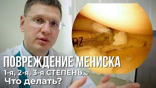 Что делать при повреждении мениска 1, 2, 3 ст коленного сустава?