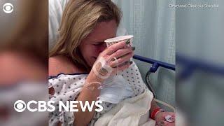 Woman with long COVID smells coffee for first time in 2 years