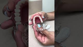 Here's a little review on how to remove your Invisalign® clear aligners or retainers! 