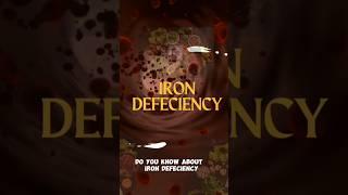 "Iron Deficiency Signs You're Ignoring!"#IronDeficiency #Anemia #nutritiontips #NutritionTips #viral