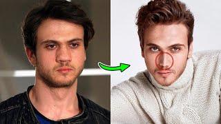 Turkish actors who have undergone plastic surgery